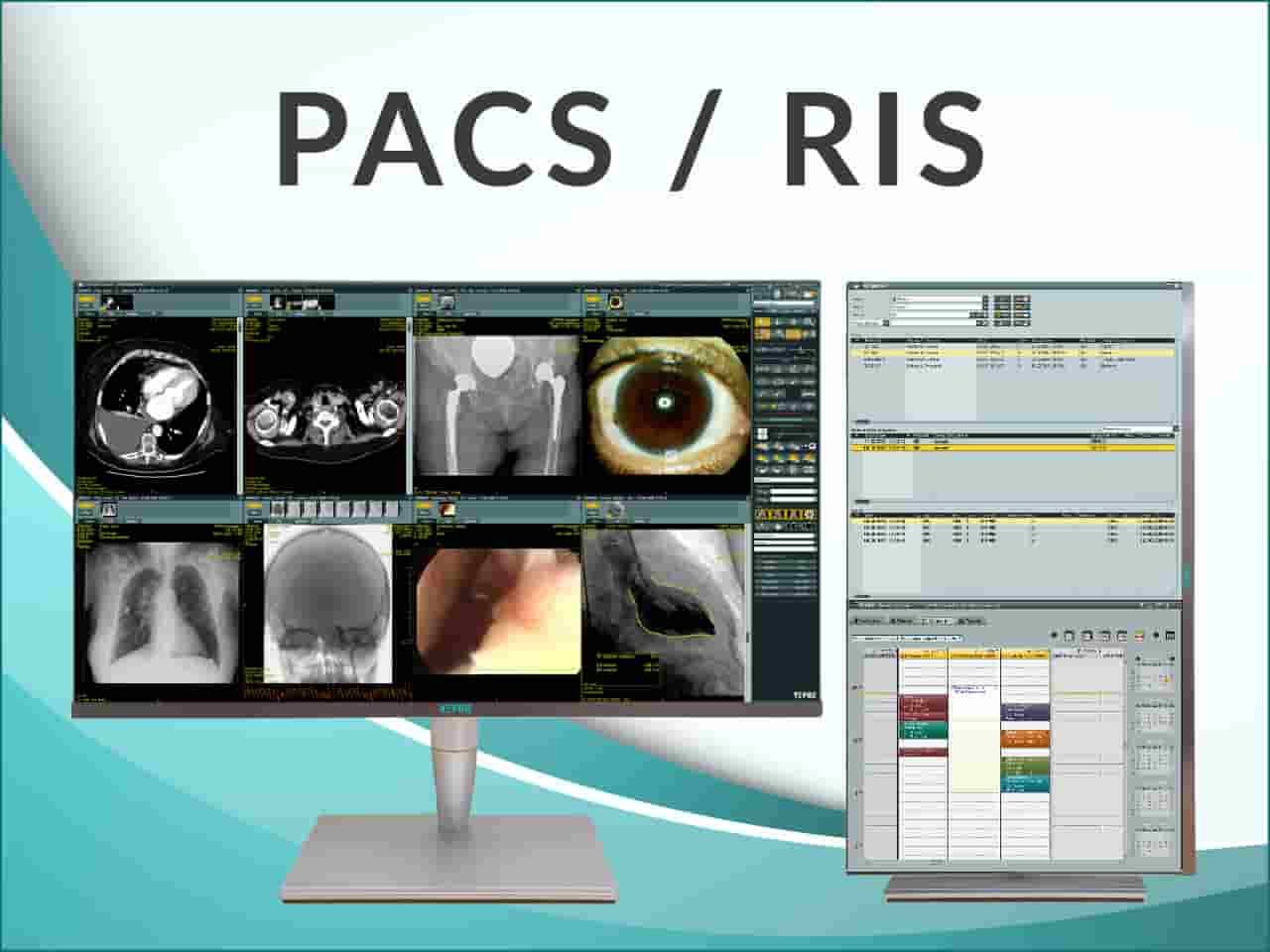 Cloud based RIS PACS system
